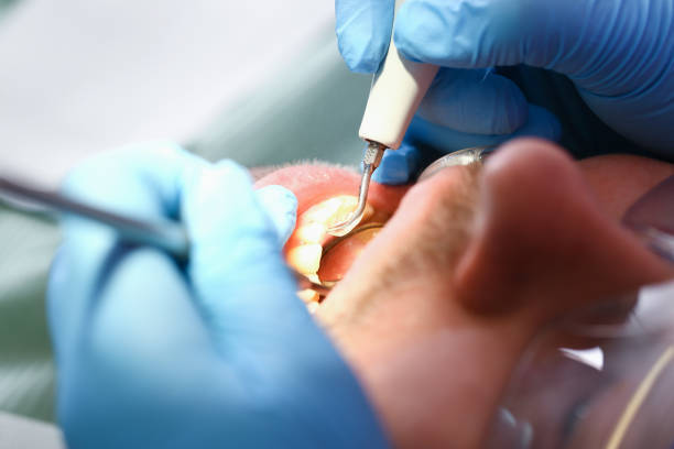 Best Pediatric Emergency Dentist in Morrice, MI