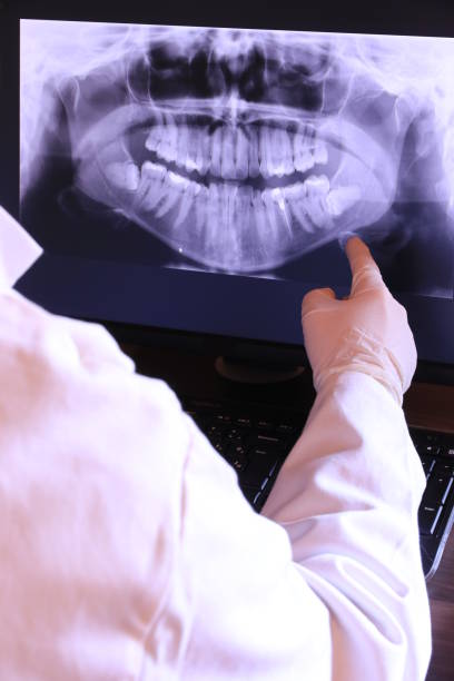 Best Emergency Tooth Extraction in Morrice, MI